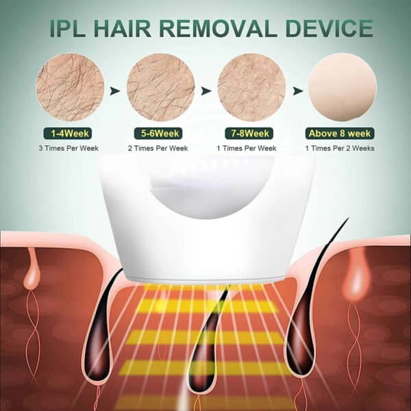 depiladora laser IPL 999.999 pulsos