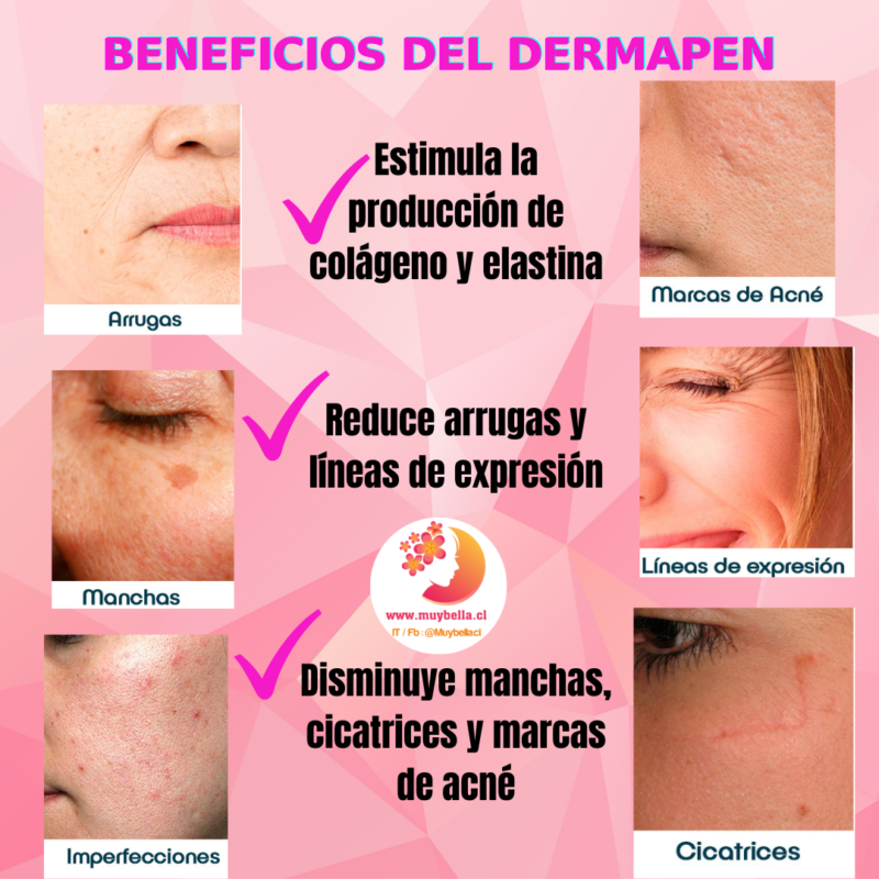 dermapen beneficios